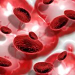 What Happens If Platelets Are High: Understanding Thrombocytosis